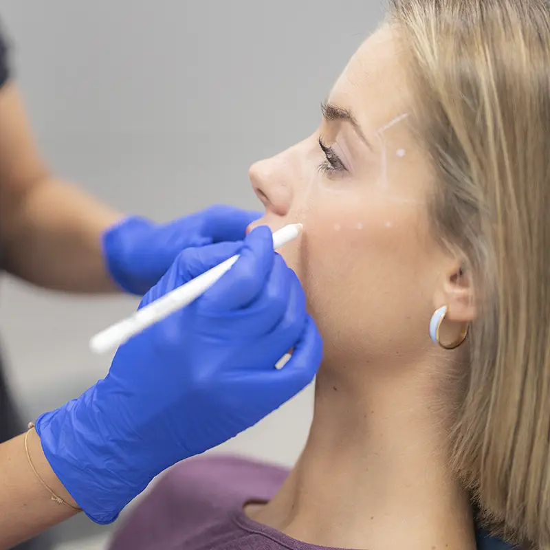 Rinomodelacion sin cirugía